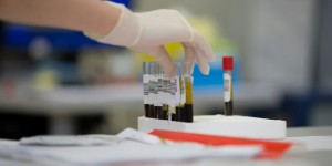 A hand is reaching to the testing tubes. 